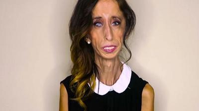 Les Stars Soutiennent Lizzie Velasquez La Femme La Plus Moche Du Monde Contre Le Harcelement Video Le Soir Plus